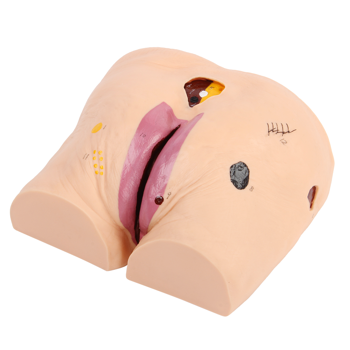 高級褥瘡護理模型