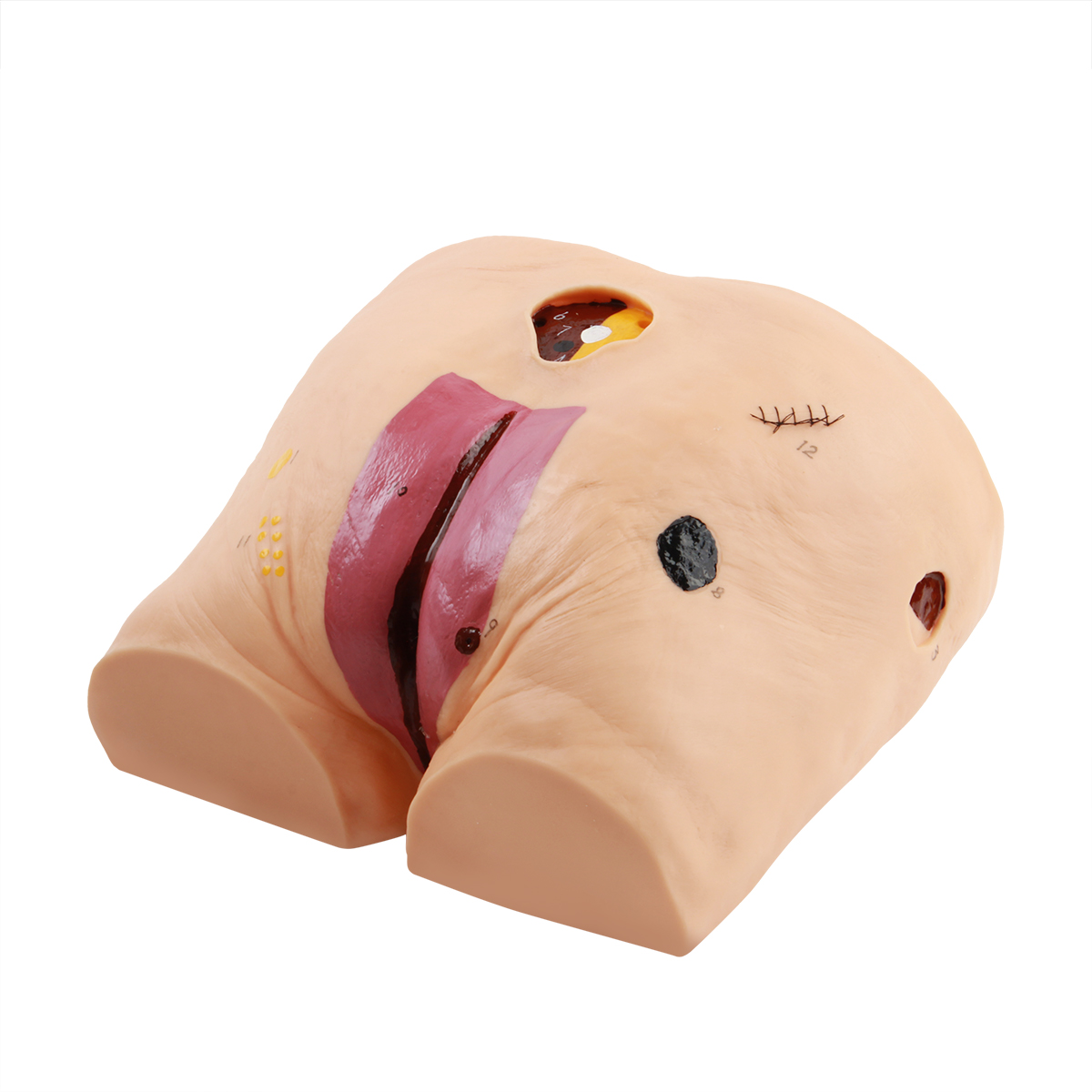 高級褥瘡護理模型