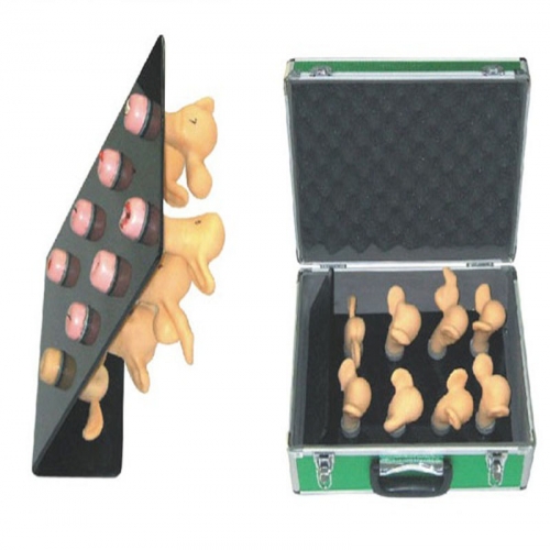  高級（jí）子宮宮勁病變模型（8件）