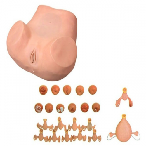 高級婦科（kē）檢查模型