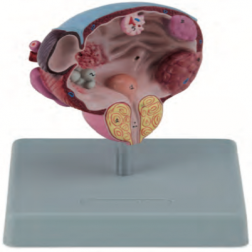 膀（bǎng）胱前列腺放大模型