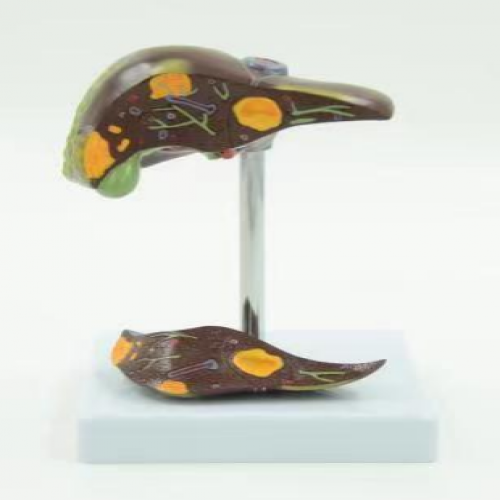 病理肝（gān）模型