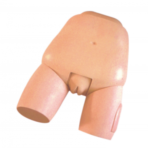 高級子宮底檢（jiǎn）查評定模型