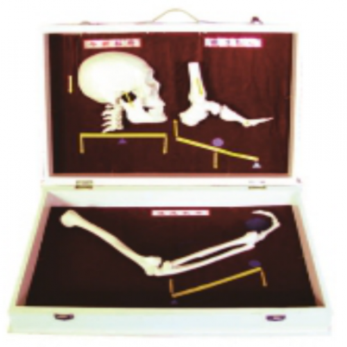 人體骨杠杆分類模型