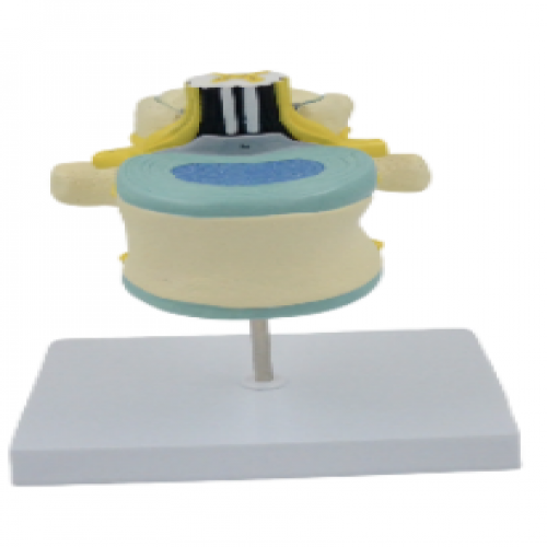  腰椎（zhuī）附脊髓（suǐ）與馬尾（wěi）神經放大（dà）模（mó）型