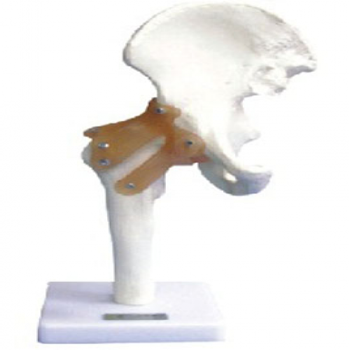 髖關節功能模型（附韌帶）