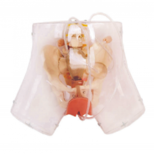 高級透明刮宮模（mó）型