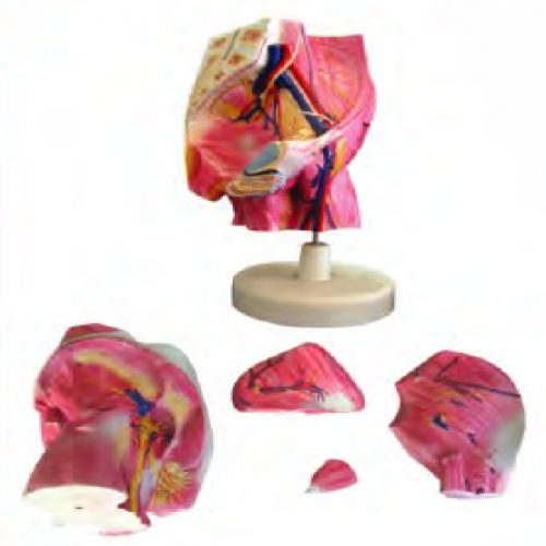 髖部局（jú）解模型