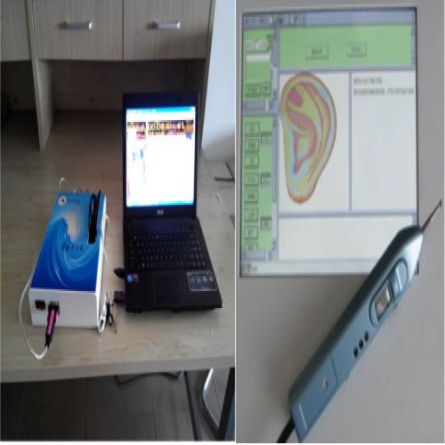 智能（néng）耳穴儀（yí）