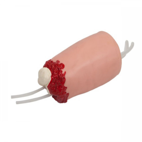 下肢外傷（shāng）斷肢止血模型