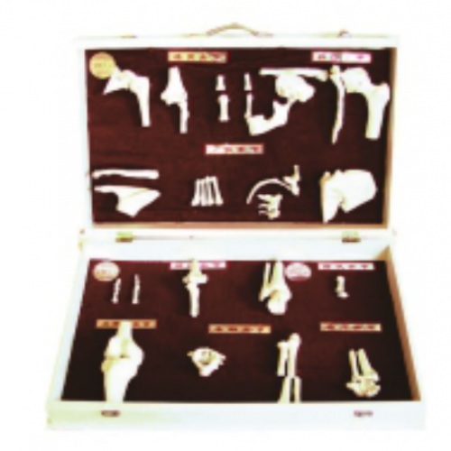 人（rén）體骨關節分類模型