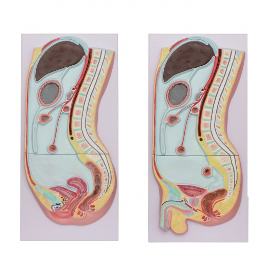 腹膜矢狀切麵（miàn）模型