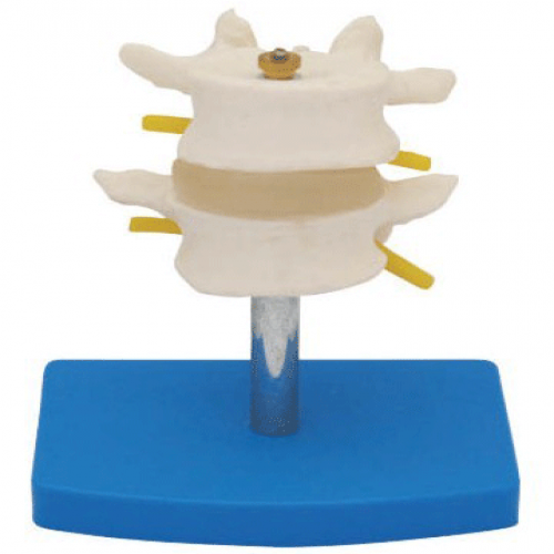 正常腰椎組（zǔ）合（二節）