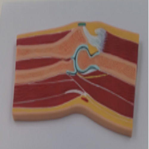 肘關節剖麵模型