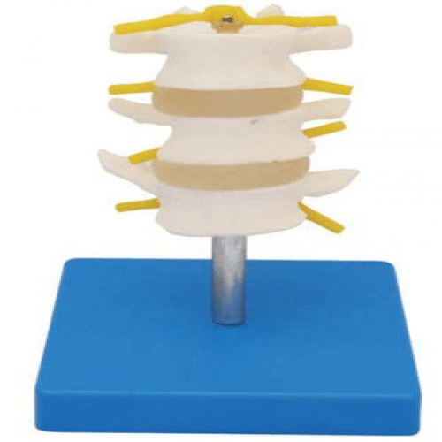 正常（cháng）腰椎組合（三節（jiē））